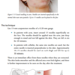 2021-06-19 19_01_25-Cosmetic Acupuncture.pdf and 4 more pages – Profile 1 – Microsoft​ Edge
